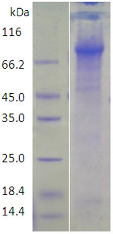 15% SDS-PAGE analysis profiles of purified KP1_0306-25-752 (CBB stained).